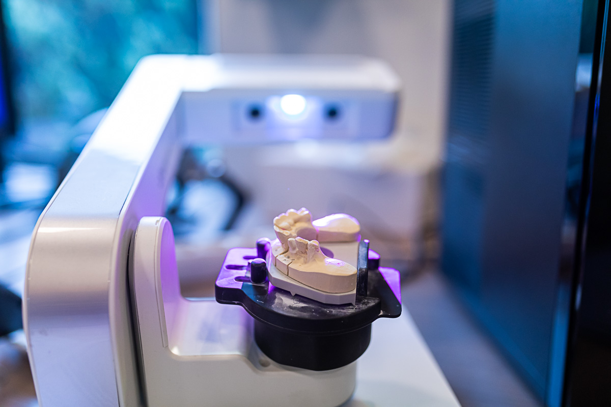 dentale scanner voor een digitale dentale workflow